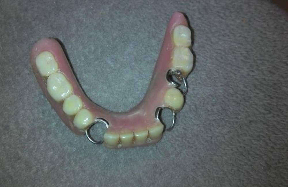 Za herňou Pod Brezinou bola nájdená zubná protéza, majiteľ sa môže hlásiť nálezkyni