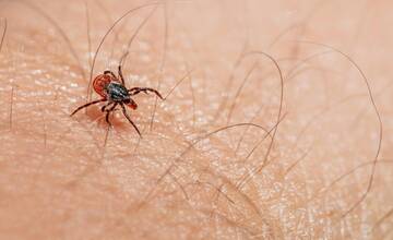 V Trenčianskom kraji pribúda ochorenie kliešťovej encefalitídy. Ako sa pred kliešťom chrániť?