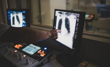 FOTO: Veľká pomoc onkologickým pacientom. Lekári v bojnickej nemocnici prvýkrát zaviedli PICC katéter