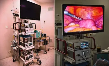 FOTO: Bojnická nemocnica získala špičkové zariadenie pre gynekológiu. Lekárom pri zákrokoch pomôže 4K technológia