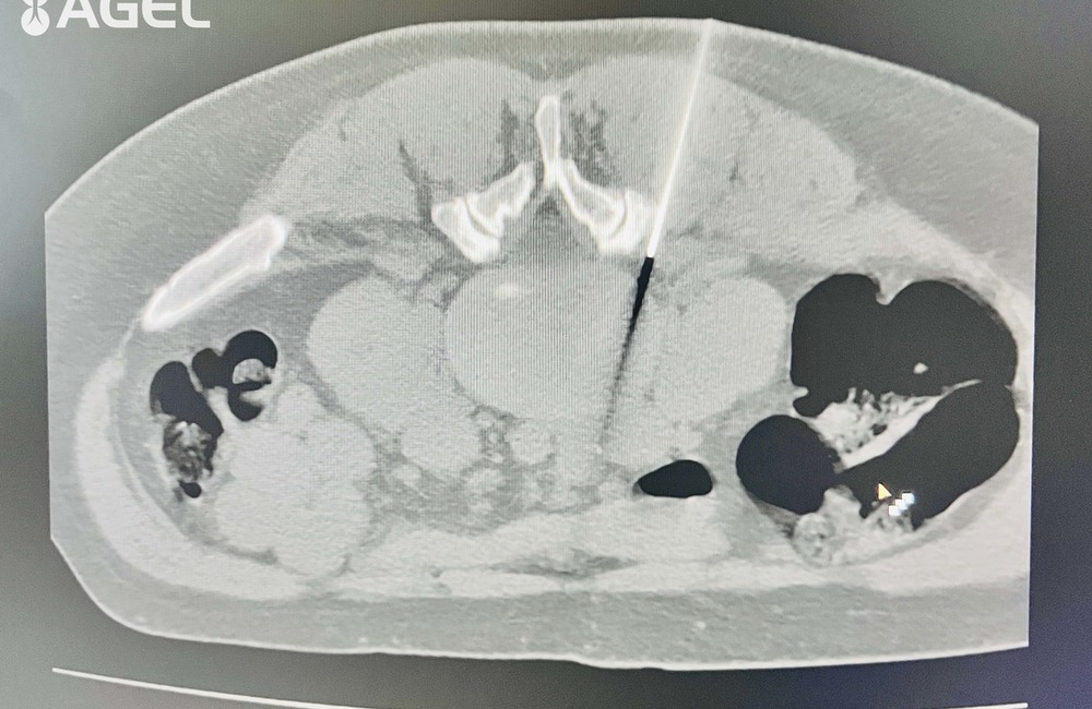 FOTO: CT pracovisko bánovskej nemocnice začalo s poskytovaním ozónoterapie, foto 1