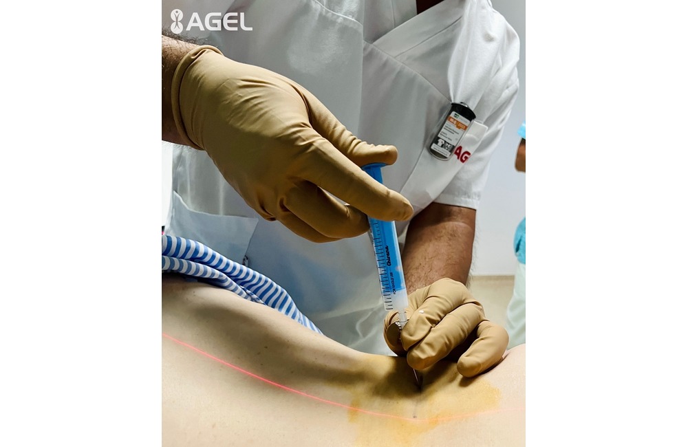 FOTO: CT pracovisko bánovskej nemocnice začalo s poskytovaním ozónoterapie, foto 3