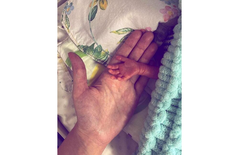 FOTO: Svetový deň predčasne narodených detí v Trenčianskej nemocnici, foto 2