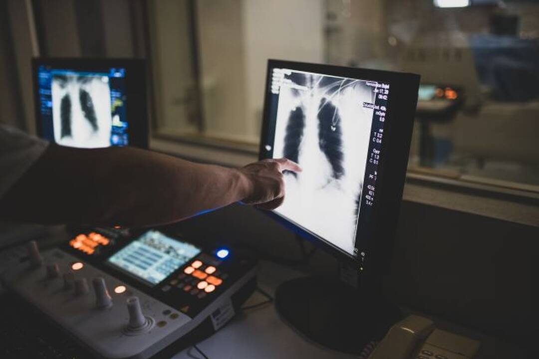 FOTO: Pomoc onkologickým pacientom na Hornej Nitre, foto 8