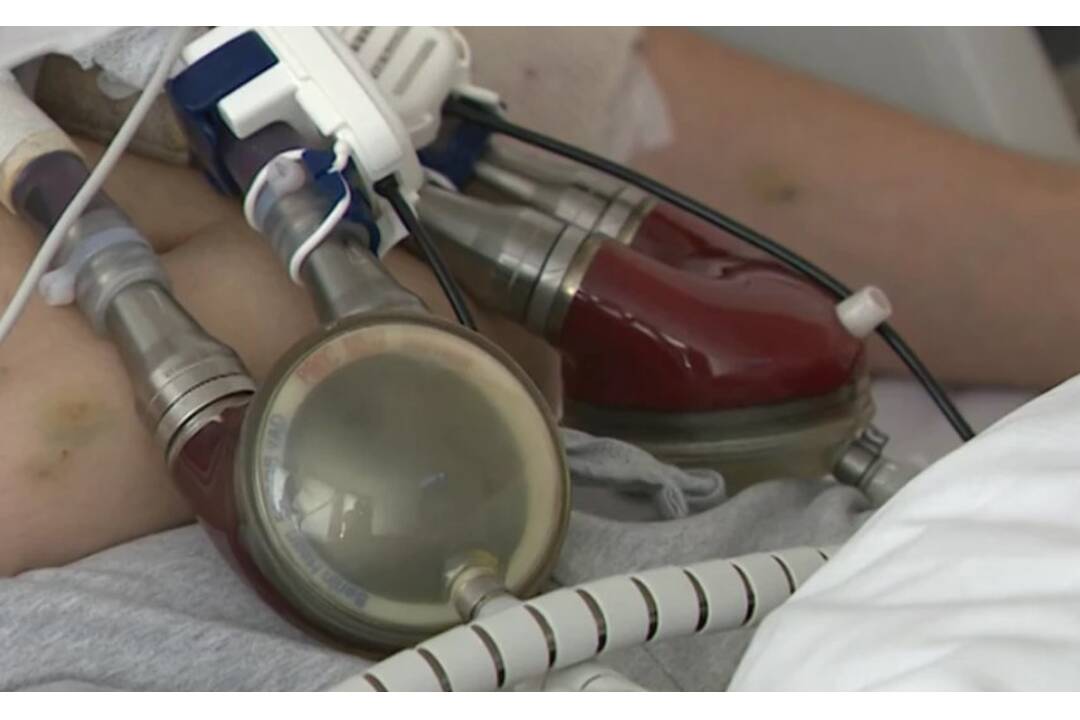 FOTO: Mladého muža drží pri živote Berlínske srdce, foto 1