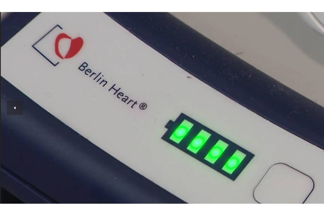 FOTO: Mladého muža drží pri živote Berlínske srdce, foto 4