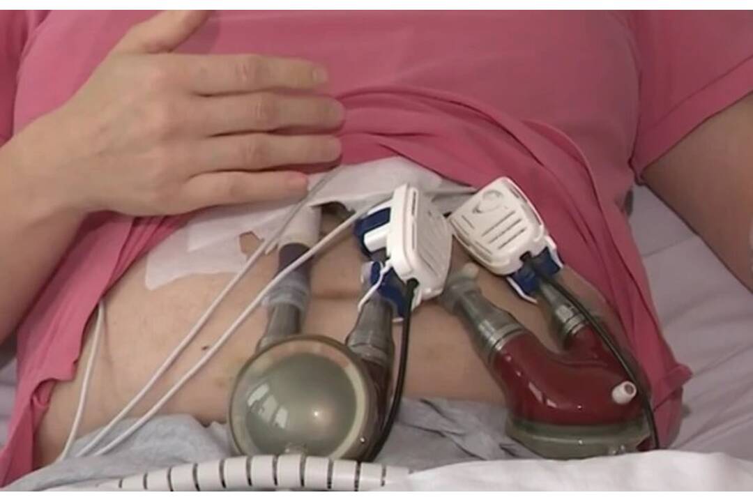 FOTO: Mladého muža drží pri živote Berlínske srdce, foto 5