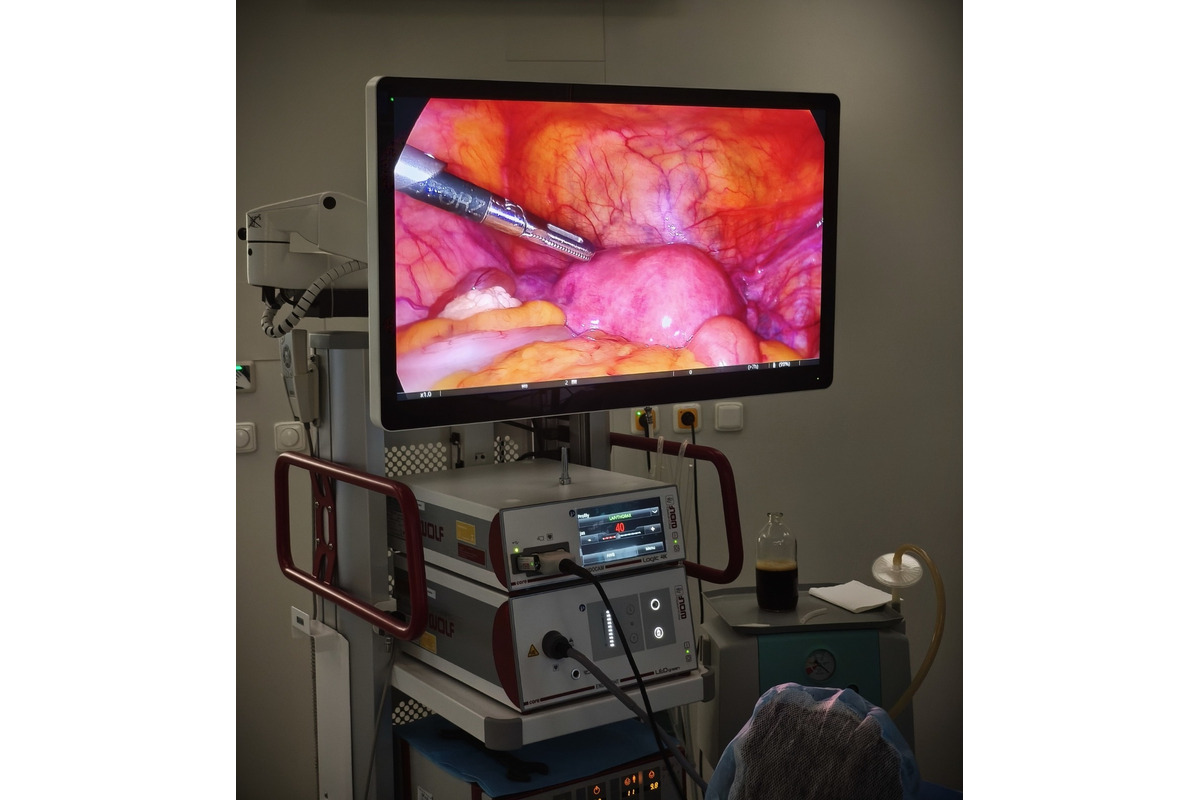 FOTO: Gynekologické oddelenie v Bojniciach má nové špičkové vybavenie. Ponúka 4K technológiu a rýchlejšie zákroky, foto 6