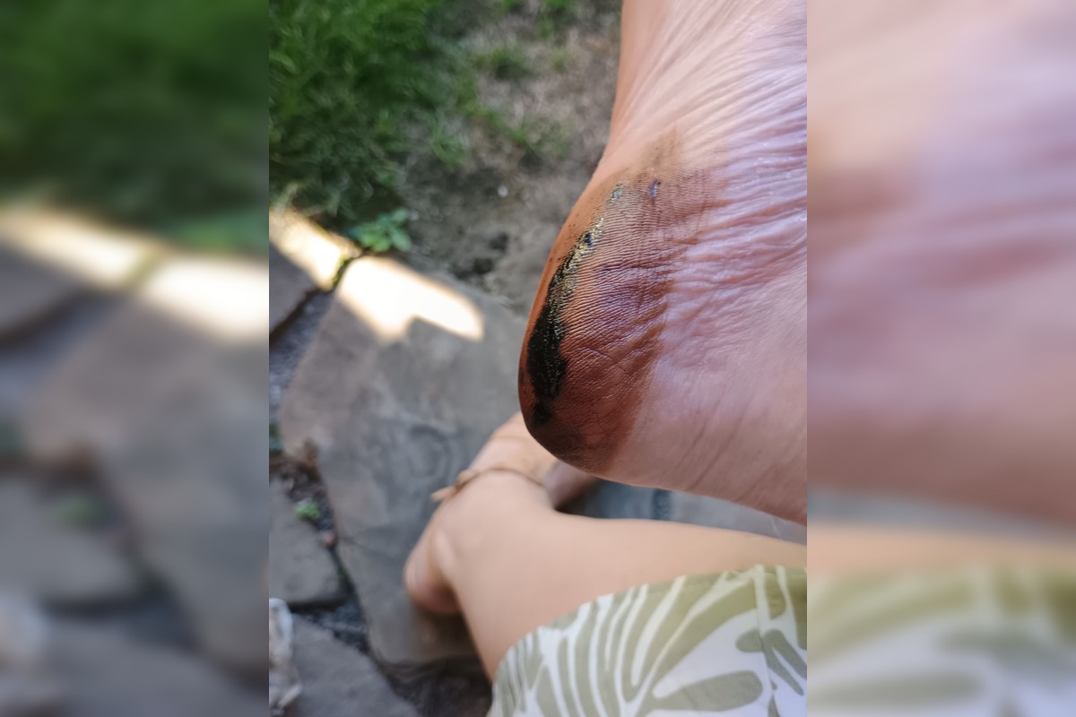 FOTO: Trenčanka stúpila do roztečenej smoly na chodníku počas prechádzky v Trenčíne, foto 4