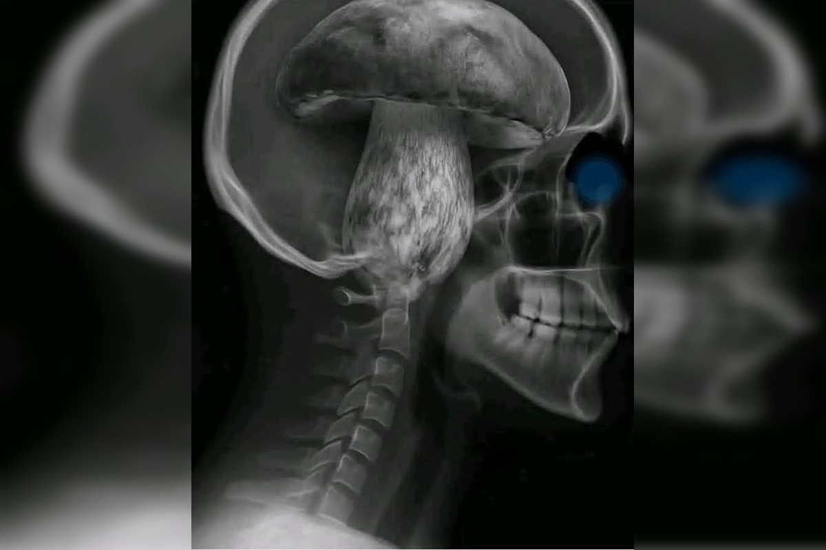 FOTO: Hubárska diagnóza zasiahla východ. Dubáky, smiech aj plné košíky, foto 1