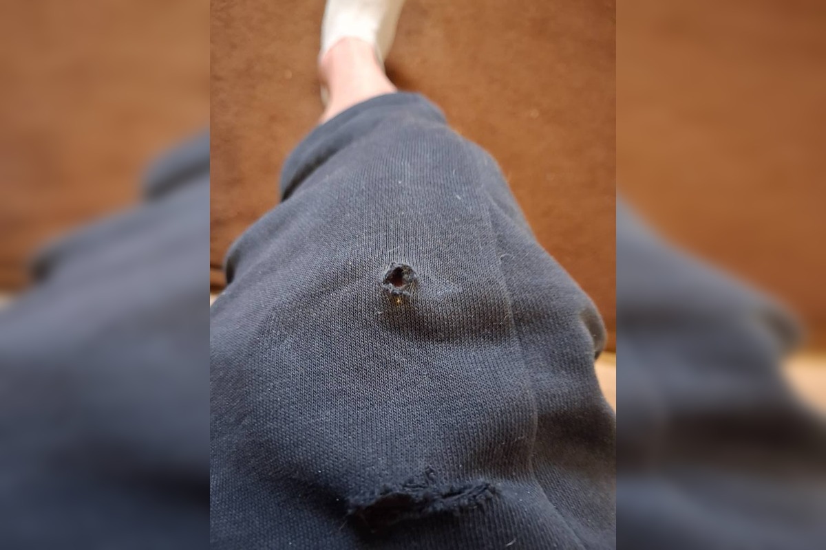 FOTO: V Dubnici nad Váhom pohrýzol pes v parku svojho majiteľa kvôli nezodpovednej psíčkarke, foto 5