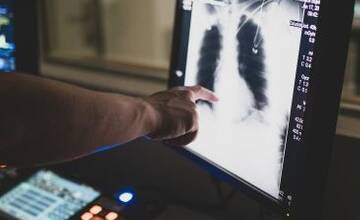 FOTO: Pomoc onkologickým pacientom na Hornej Nitre