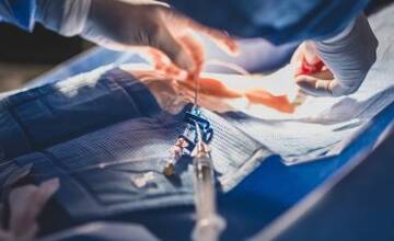 FOTO: Pomoc onkologickým pacientom na Hornej Nitre