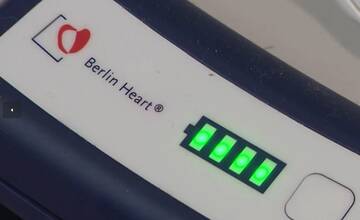 FOTO: Mladého muža drží pri živote Berlínske srdce