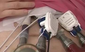 FOTO: Mladého muža drží pri živote Berlínske srdce