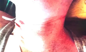 FOTO: Seniori sa poriadne opili, najskôr žena napadla muža, potom muž škrtil ju