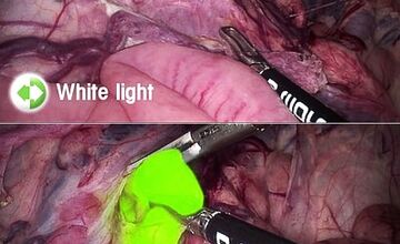 FOTO: Gynekologické oddelenie v Bojniciach má nové špičkové vybavenie. Ponúka 4K technológiu a rýchlejšie zákroky