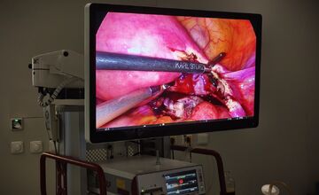 FOTO: Gynekologické oddelenie v Bojniciach má nové špičkové vybavenie. Ponúka 4K technológiu a rýchlejšie zákroky