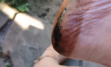 FOTO: Trenčanka stúpila do roztečenej smoly na chodníku počas prechádzky v Trenčíne