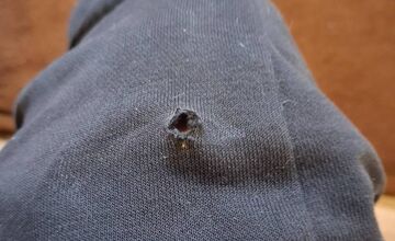 FOTO: V Dubnici nad Váhom pohrýzol pes v parku svojho majiteľa kvôli nezodpovednej psíčkarke