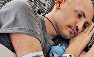 FOTO: Bratov stretol rovnaký osud, rodina bojuje o zdravie dvoch z troch detí 