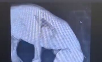 FOTO: Medvedie siroty z Hrboltovej absolvovali prvý röntgen. Veterinári si vydýchli