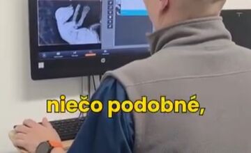 FOTO: Medvedie siroty z Hrboltovej absolvovali prvý röntgen. Veterinári si vydýchli